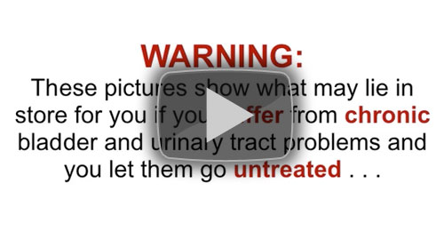 Click To Play Video - Warning, these pictures show what may lie in store for you if your UTI's continue to get worse
